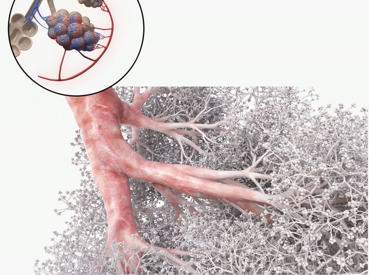 Bronchial cells — airway inflammation