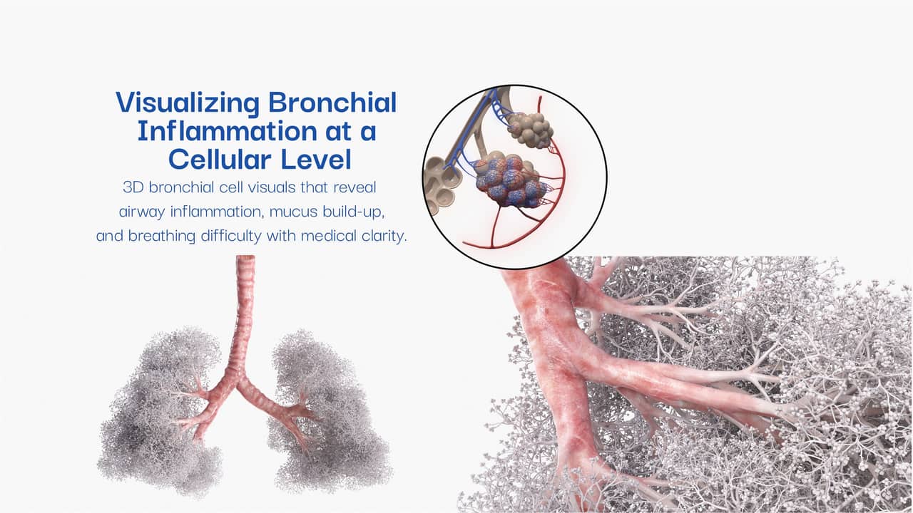 Bronchial inflammation