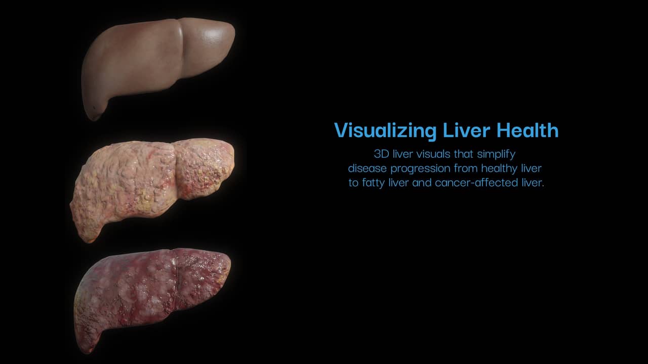 Liver health