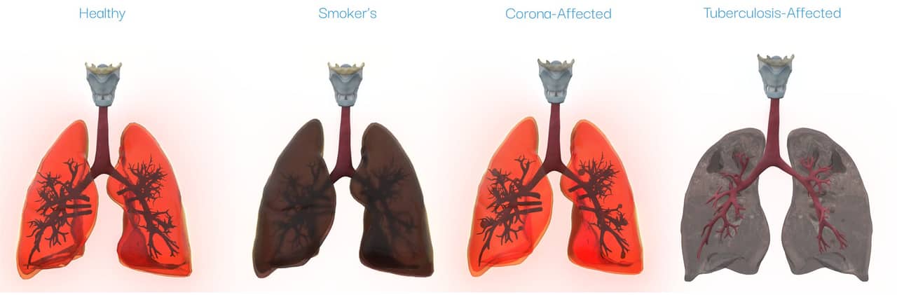 Lung — health to disease